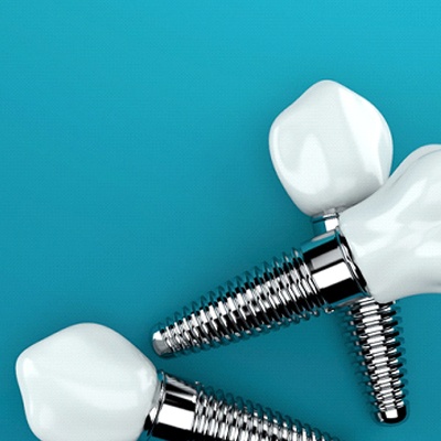 Three traditional dental implants with restorations against teal background
