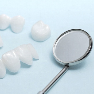All-ceramic dental bridges and crown
