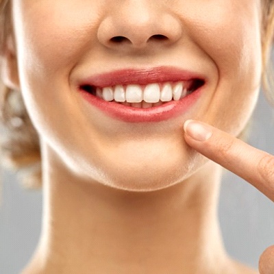 woman pointing to her perfect smile