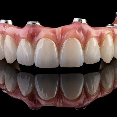 an example of hybrid dentures in Springfield