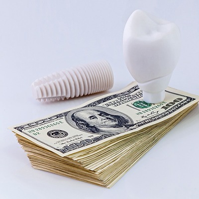 Stack of money below crown and next to dental implant in Springfield, MO