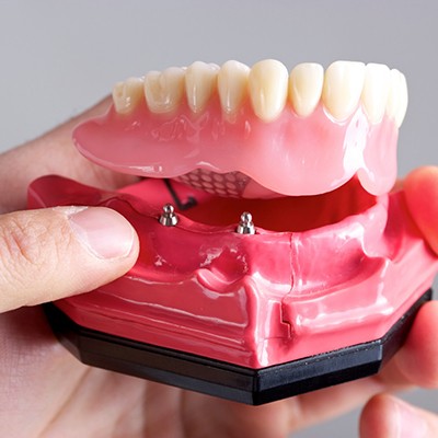 dentist holding a model of an implant denture