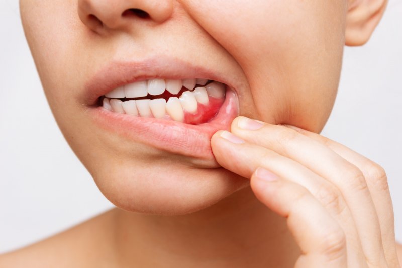 portrait of someone showing off their infected gums