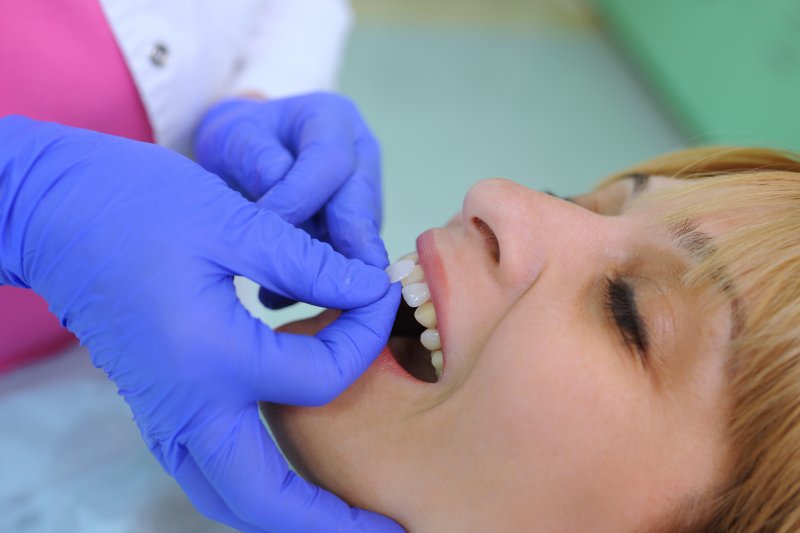 Woman smiling as dentist wearing blue latex gloves compares veneer example next to her natural teeth